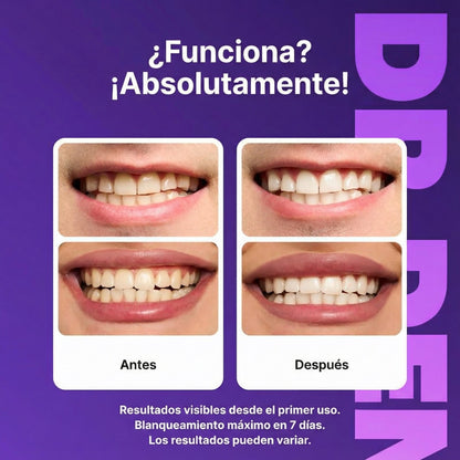 (SUPER 2X1) Tiras Blanqueadoras